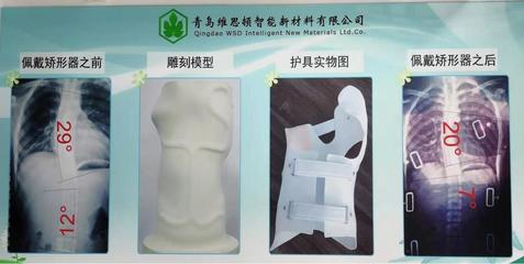 拯救&ldquo;維納斯&rdquo; 「維思頓」開創數字化仿真智能矯形